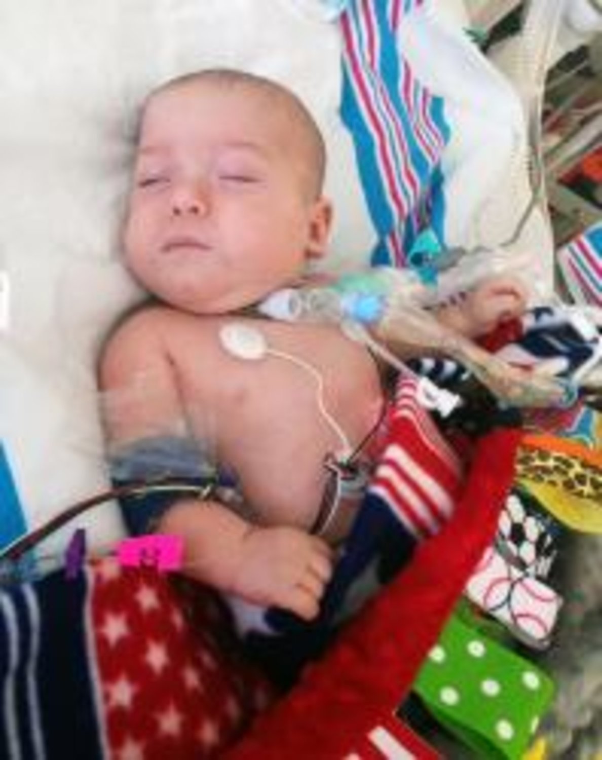Knox Pugh is seen here at Children's Medical Center in Dallas, where he has lived since he was born prematurely in August 2013.